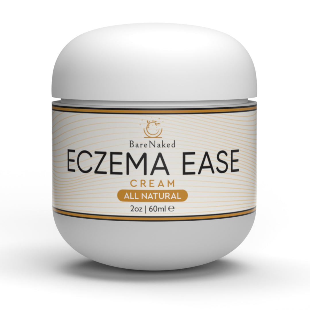 Image of Eczema Ease – Herbal Relief for Itchy, Cracked, and Sensitive Skin